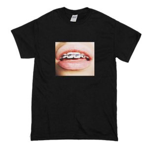 Braces Teeth T-Shirt (BSM)